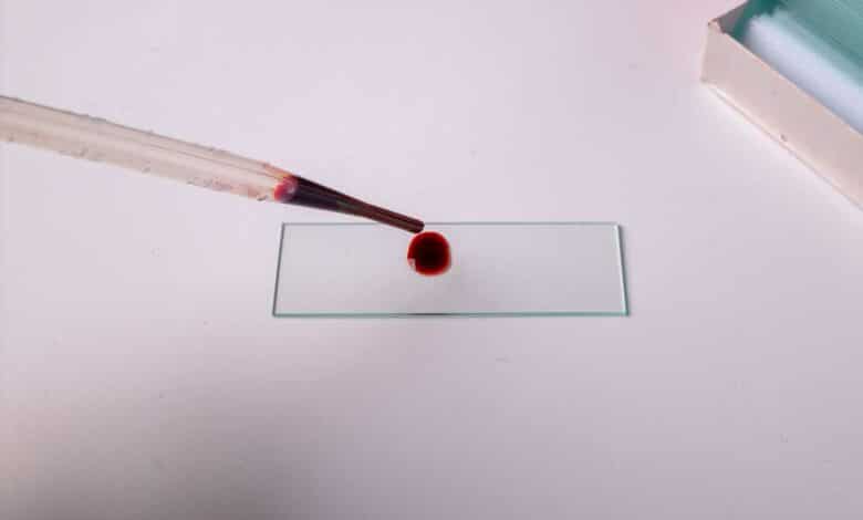 Une goutte de sang en laboratoire.