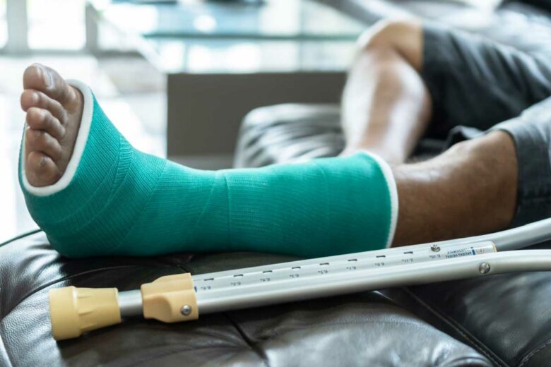 Une personne avec la jambe cassée plâtrée.