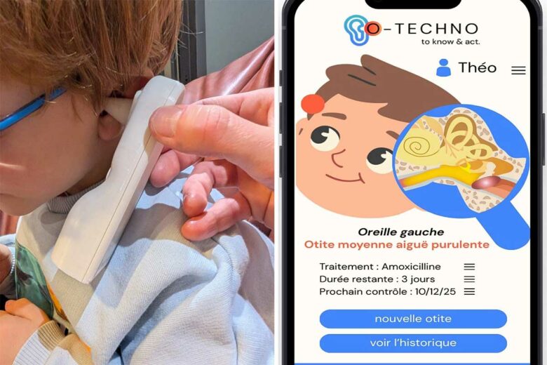 Vérification de l'oreille et application mobile.