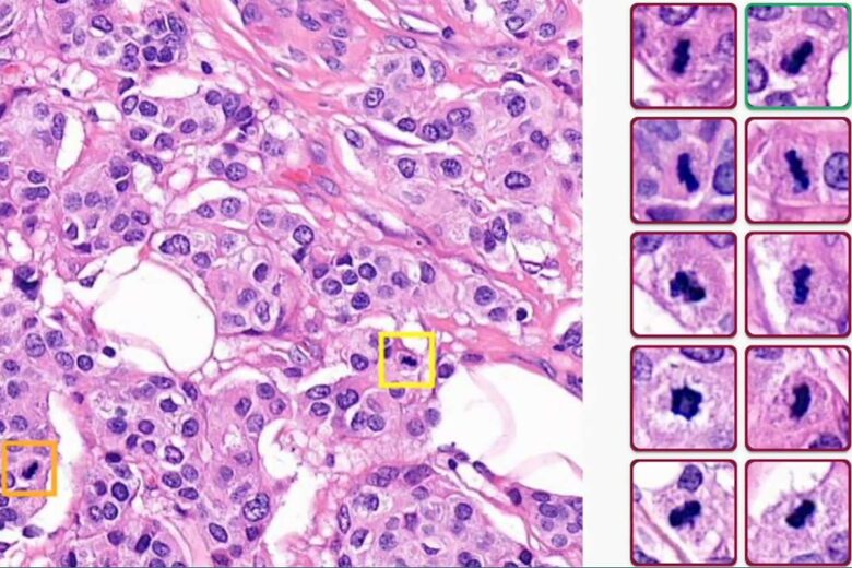 Détection de tous les objets de mitose et les points chauds de mitose dansles régions cancéreuses.