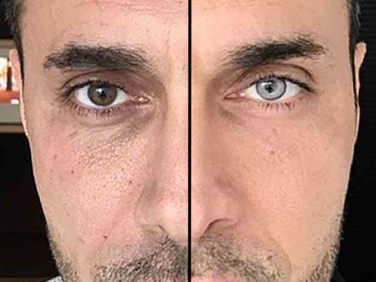 Voici Comment Il Est Possible De Changer La Couleur De Ses Yeux Neozone